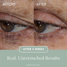 Load image into Gallery viewer, Lift &amp; Smooth Eyelid Treatment
